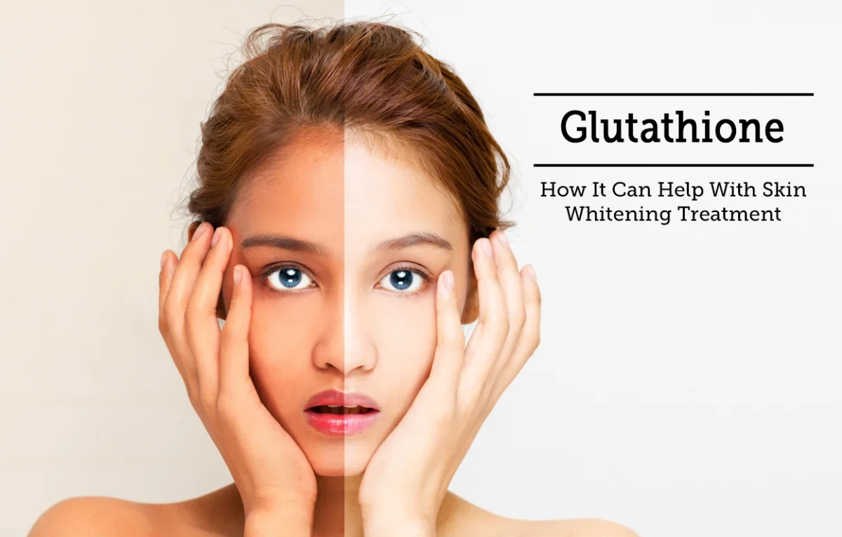Acquiring Glutathione IV in San Jose: A Guide