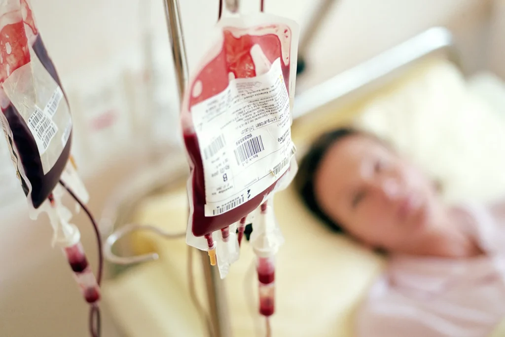 Iron Infusion IV Therapy – Revitalize Your Energy and Health